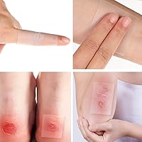 XYYLLL Hydrokolloid Pflaster Rolle 5 cm x 5 m — Bild 6