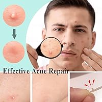 Zemolo Pickel Patch Hydrokolloid 300er-Pack — Bild 4