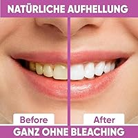 Glowee Whitening Strips 14 Anwendungen — Bild 3