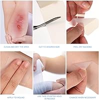 XYYLLL Hydrokolloid Pflaster Rolle 5 cm x 5 m — Bild 3