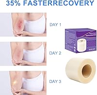 XYYLLL Hydrokolloid Pflaster Rolle 5 cm x 5 m — Bild 4