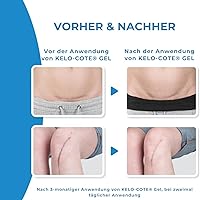 KELO-COTE Silikon-Narbengel 6g — Bild 9