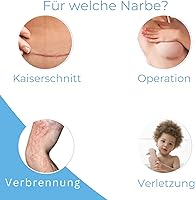 KELO-COTE Silikon-Narbengel 6g — Bild 5