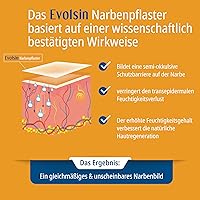 Evolsin Silikon Narbenpflaster 200cm — Bild 3