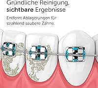 WonderSmile Munddusche PRO — Bild 9
