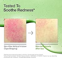 Anua Azelaic Acid 10 Redness Soothing Serum 30ml — Bild 3