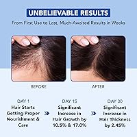 Botanic Hearth Rosmarinöl 198 ml — Bild 4