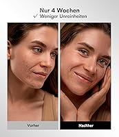 INIA IN-FM002 LED Gesichtsmaske — Bild 6