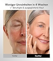 INIA IN-FM002 LED Gesichtsmaske — Bild 5