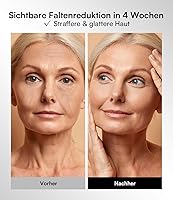 INIA IN-FM002 LED Gesichtsmaske — Bild 4