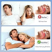 BTkviseQat Nasenpflaster 60er-Pack — Bild 4