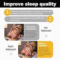 hephboard Nasenstrips DE60 60er-Pack — Bild 3