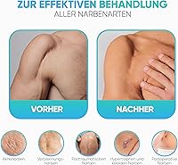 Health Press Narbengel 20 ml — Bild 2
