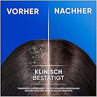 Head & Shoulders Classic Clean 2in1 Anti-Schuppen-Shampoo 800ml — Bild 6