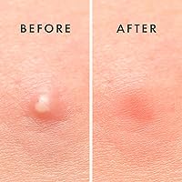 Rael Miracle Overnight Patch 52 Stück — Bild 7