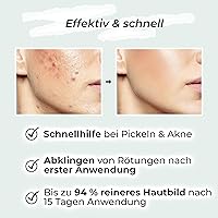 Vigorous Zinksalbe 60ml — Bild 2